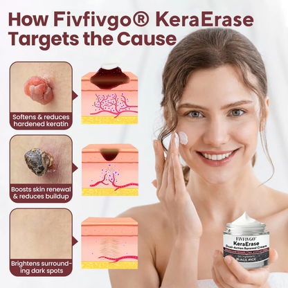 Fivfivgo® KeraErase Dual-Action Renewal Cream