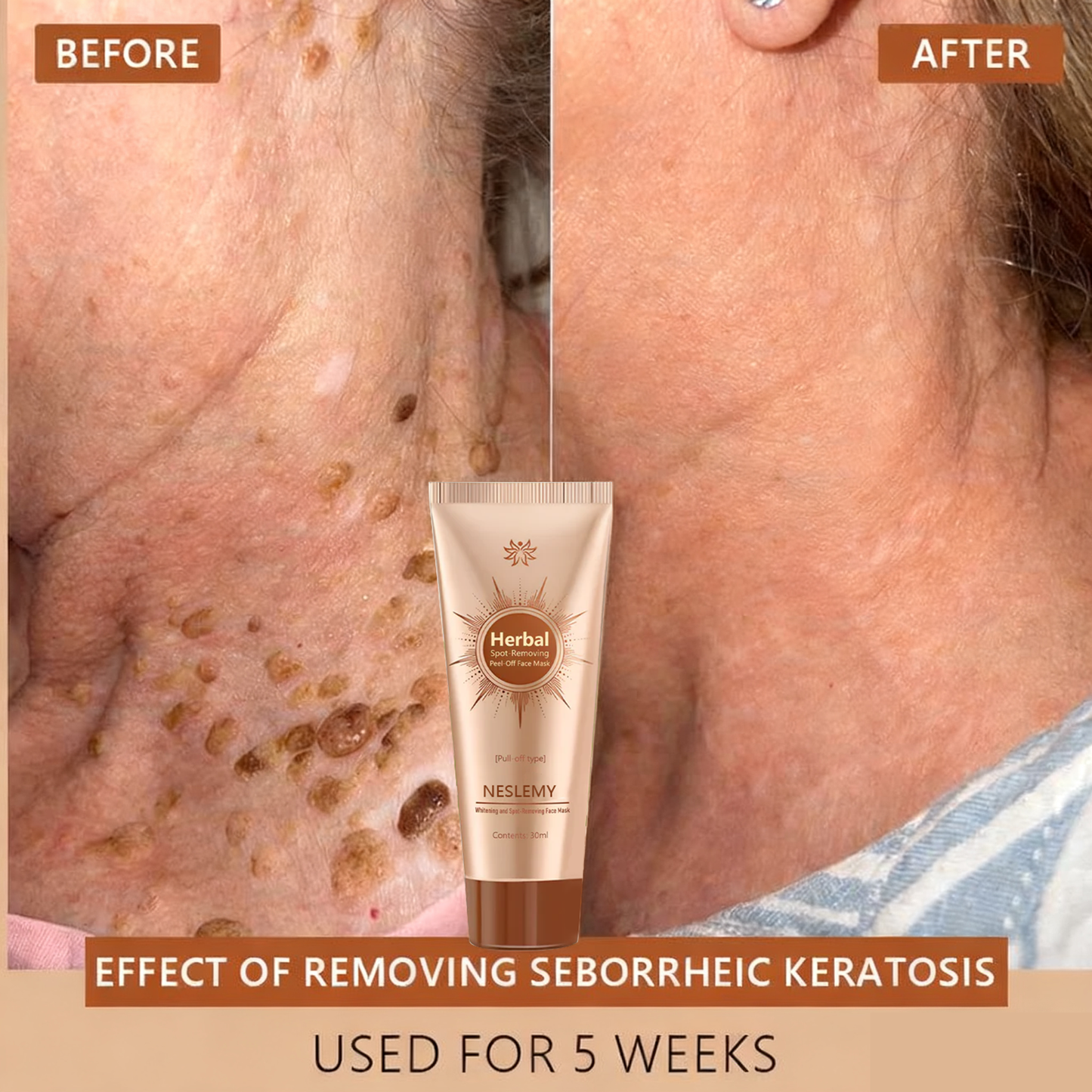 Mascarilla facial blanqueadora y eliminadora de manchas Adecuada para rostro y cuerpo – 👩‍⚕️ Los ingredientes naturales eliminan de forma permanente las manchas de la edad, las pecas, las manchas solares y las manchas hepáticas.