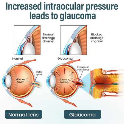 Timilk® OptiFusion Nano Eye Drops Serum