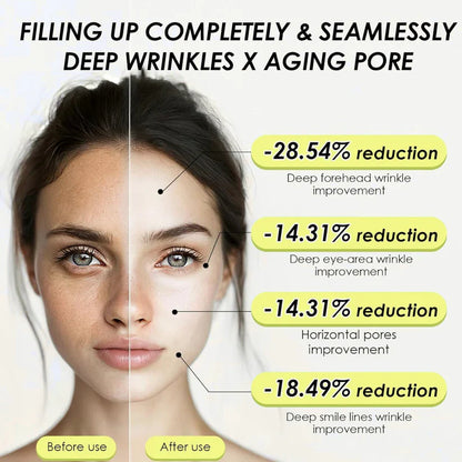 Aethreil™Retinal Shot Tightening Booster