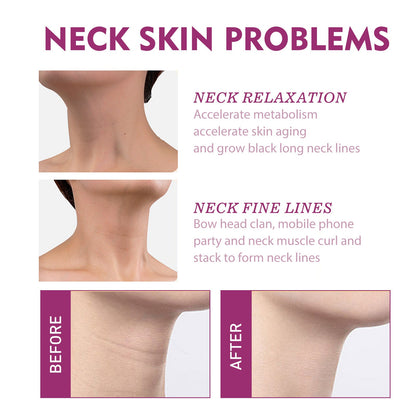 Spain NECKPON Hydrolyzed Collagen Neck Cream