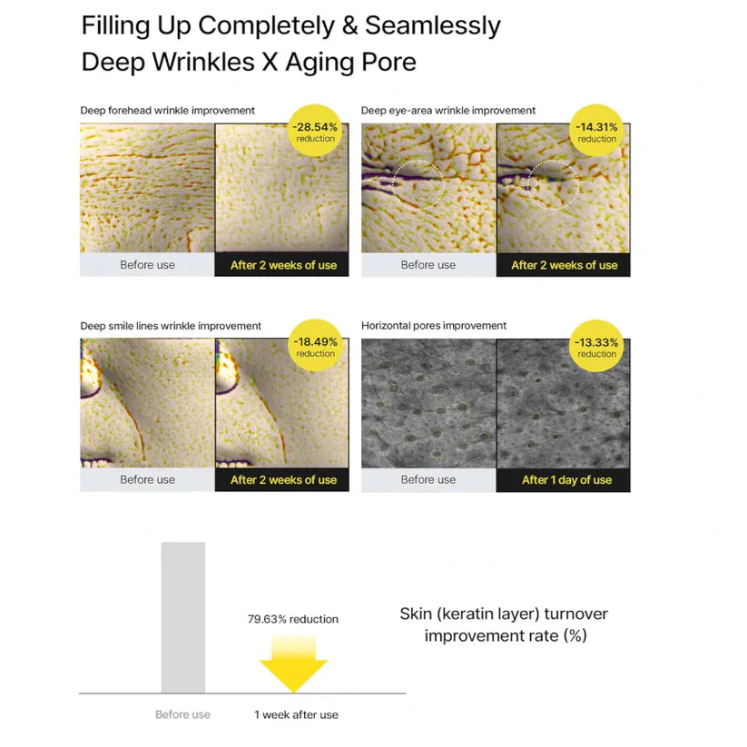 Aethreil™Retinal Shot Tightening Booster